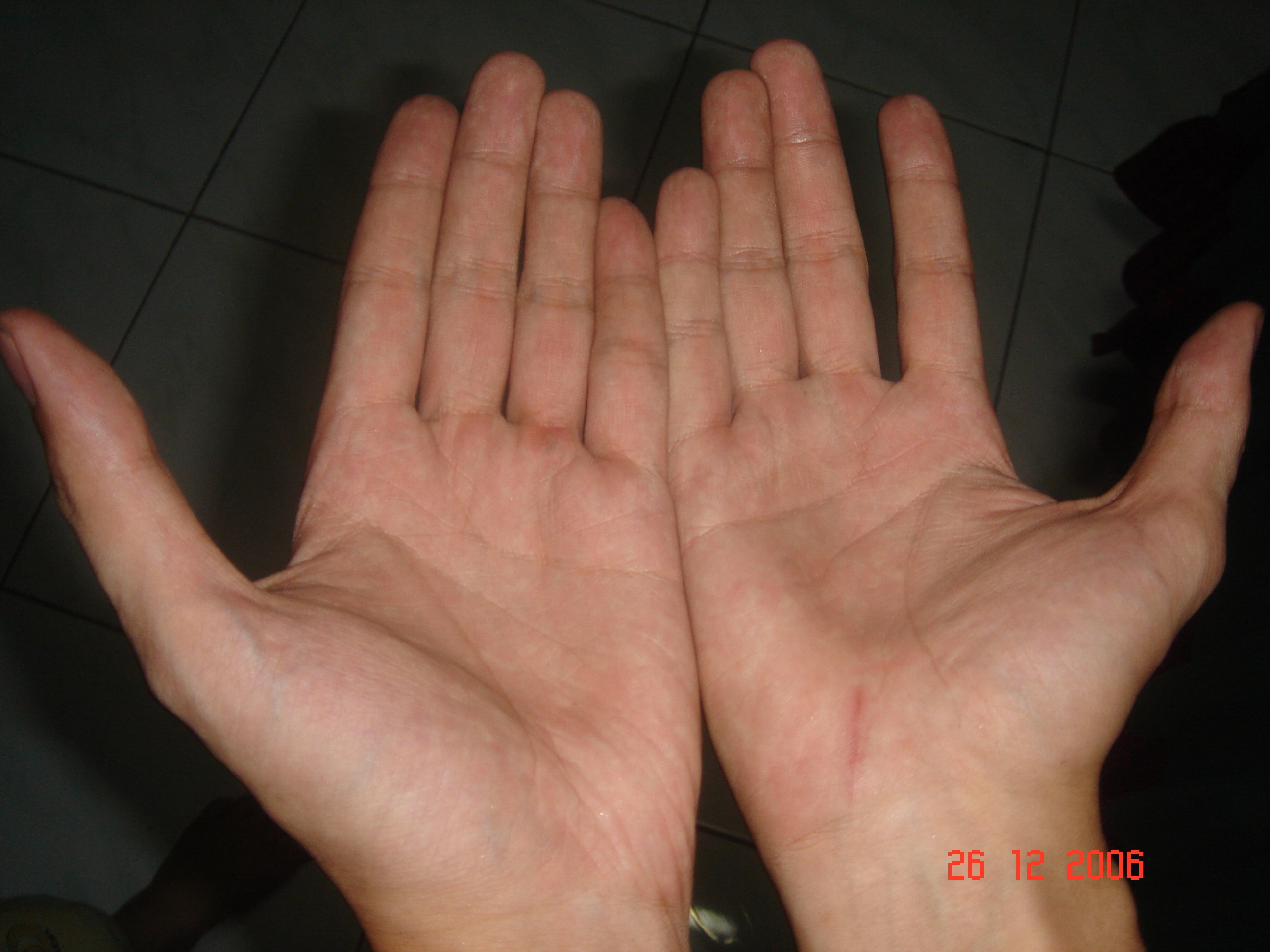 both hands low.JPG