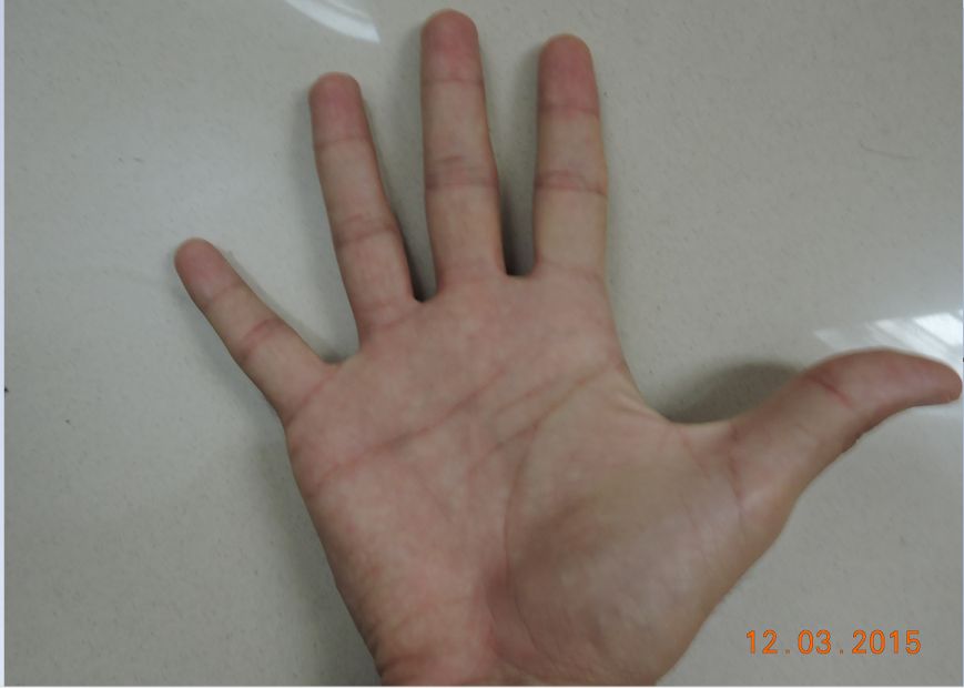 right_hand_small_248x.jpg